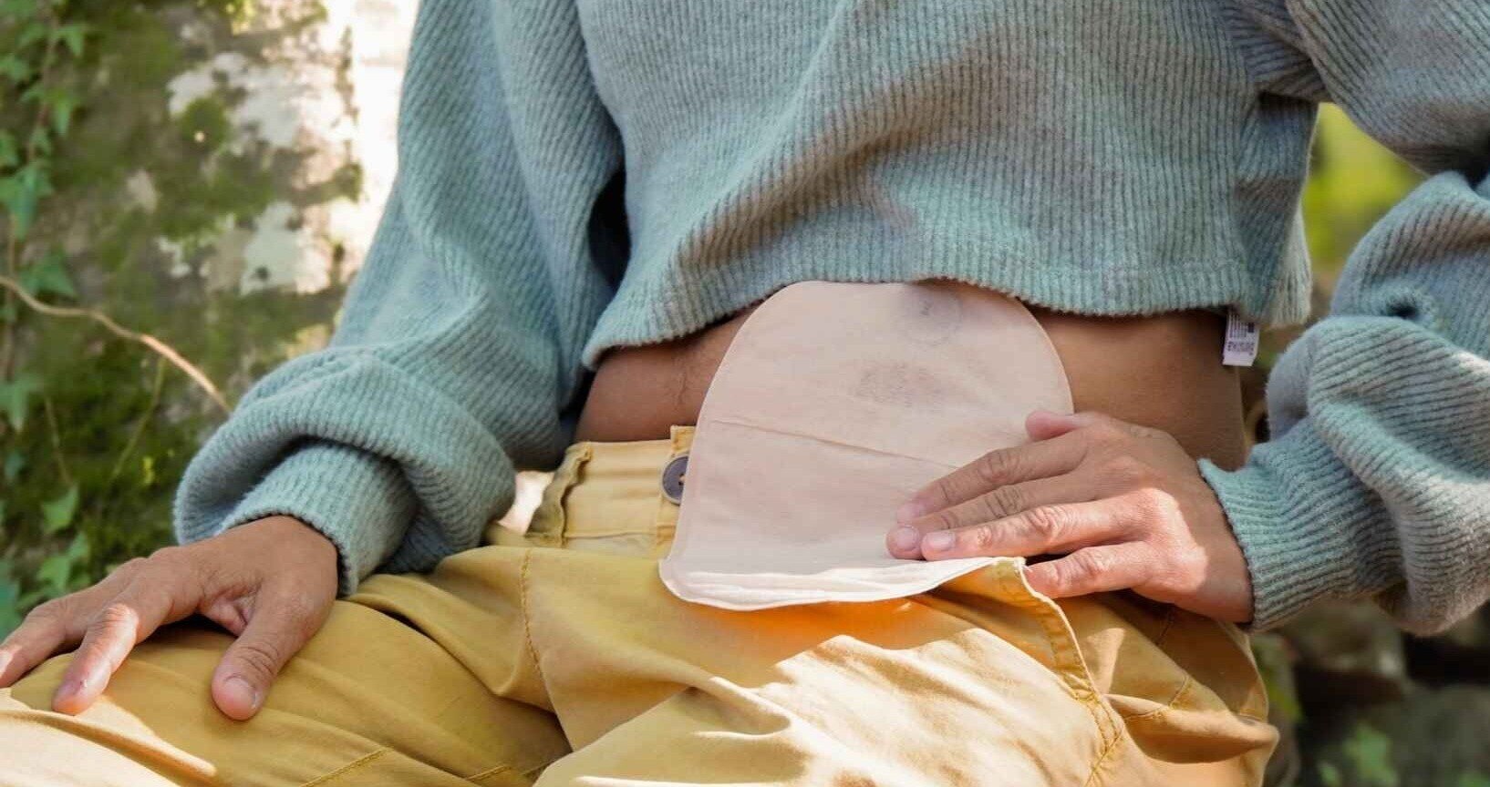 Header-person-with-ostomy-bag-in-belly-sitting-in-a-forest