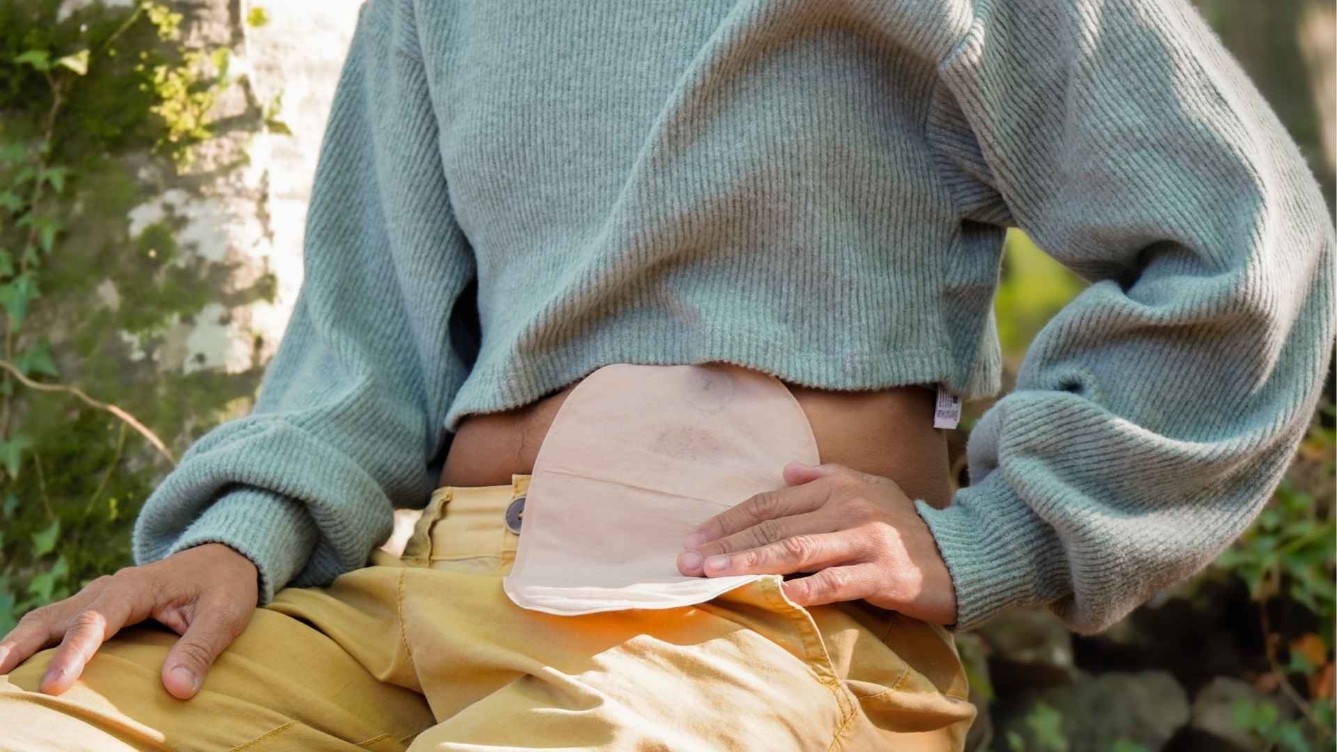 Person-with-ostomy-bag-in-belly-sitting-in-a-forest
