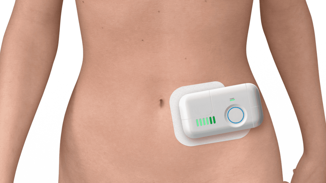 Medical-adhesive-tape-application-large-volume-injector-on-skin