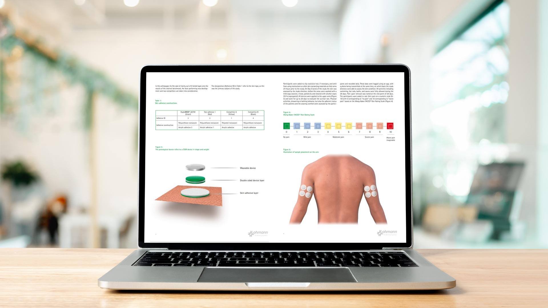 Laptop-on-a-desk-showing-Lohmann-download-file-of-medical-wearables-whitepaper